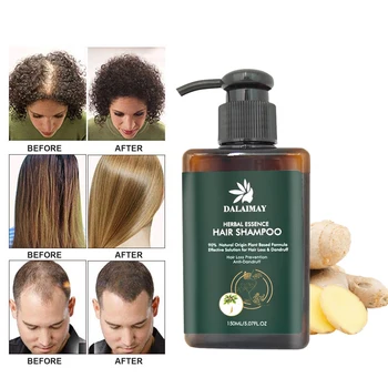 150ml Rast Vlasov Šampón Zázvor A Polygonum Multiflorum Vlasy Šampón proti padaniu Vlasov, Hrubé Prirodzené Vlasy Šampón