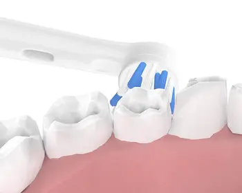 16PCS Kefka Hlavice Oral B, Náplne sensiflex na Elektrické zubné Kefky, Zahnutá Štetiny pre Účinné Odstránenie Plaku