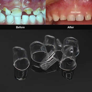 64pcs Zubné Predným Priehľadným Korunách Listnatých Zuby Dospelých a dieťa Zubár Nástroje, Bielenie Zubov, Matreials