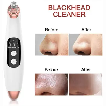 Akné Odstraňovač Elektrické Pórov Cleaner Blackhead Vysávač Nos Tváre Cleaner Multifunkčné Blackhead Odstraňovač