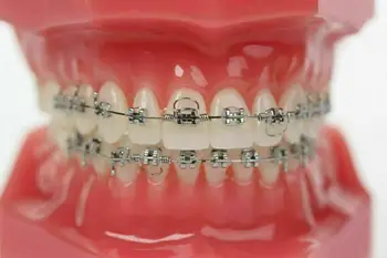 Goodman Zubné Ortodontická Torquing Krútiaci Moment Obdĺžnikový Jar Jedno Predné Dvere Tvar 20 Kusov