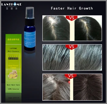 Lanthome prírodný Zázvor extrakt vlasy rýchly rast vlákniny spray, vlasový folikul stimulácia rásť podstate kvapalina pre výrobok pre starostlivosť o vlasy