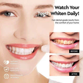 Nové Bieliace Zubné Súpravy 3 Bieliace Gél Perá 1 Tvarovanie Vaničky 1 Bielenie Zubov Svetlo Zuby Odstrániť Škvrny Nástroje