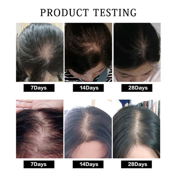 Rýchlo Silný Rast Vlasov Podstate Strata Vlasov Esenciálny Olej, Kvapalina Liečba, Prevencia vypadávania Vlasov Starostlivosť o Vlasy Produkty 20ml