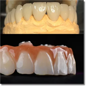 UT extrémne 9512mm najlepší estetický efekt zubných zirconia bloky pre zubné laboratória zirkonzhan