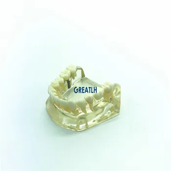 Zubný implantát zariadenia Most Model spodnú Čeľusť, zuby Implantát Typodont stomatológia model vyučovania