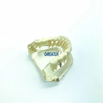 Zubný implantát zariadenia Most Model spodnú Čeľusť, zuby Implantát Typodont stomatológia model vyučovania