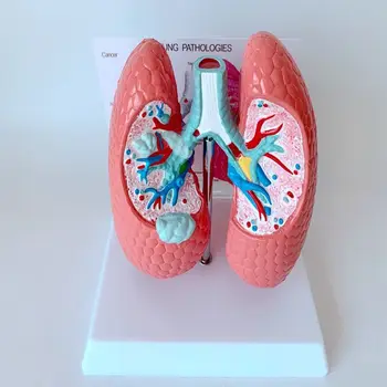 Ľudský respiračný systém zdravých pľúc anatómie výučby model pľúc patológia ovládanie modelu dymu pľúc model